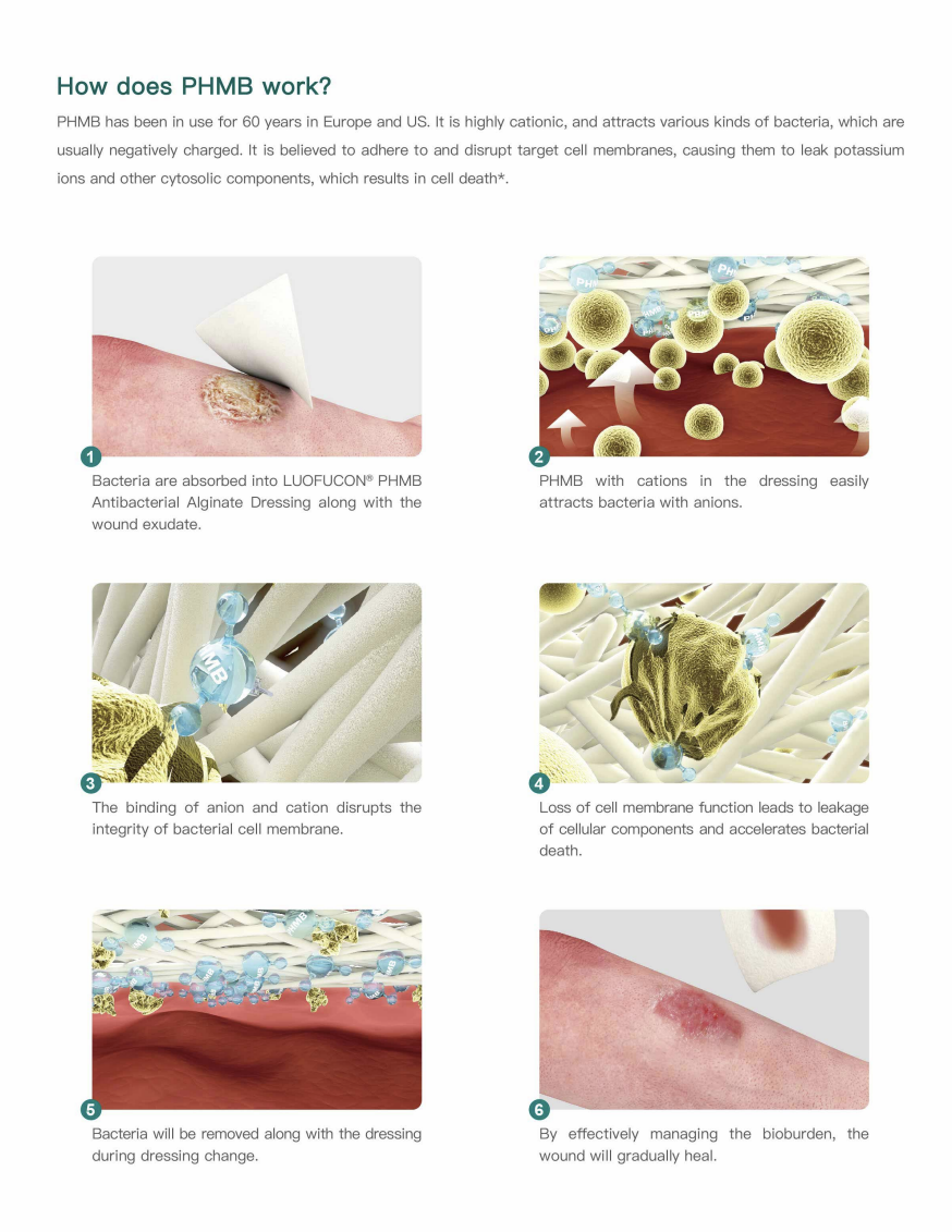 Penyerapan Tinggi Steril Antibakteria PHMB Alginate Dressing untuk hemostasis